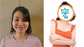 越南兔唇女「被批不祥」！求職被拒 整形後逆轉 Tình Tũn臉書