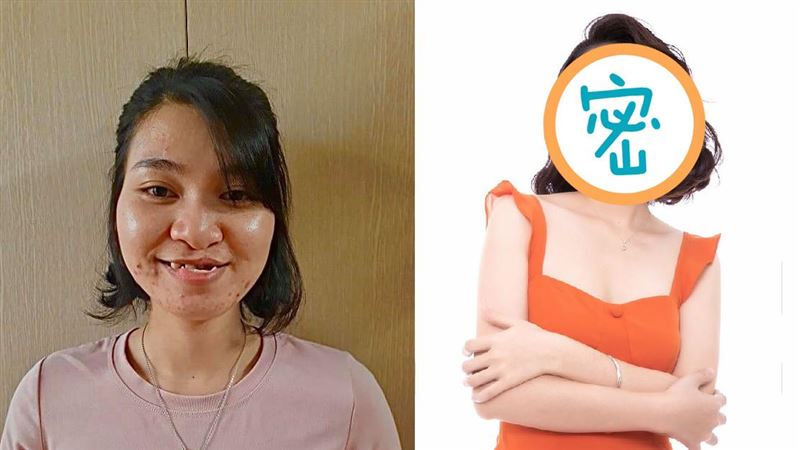 兔唇女被批不祥　整形後顏值驚呆網