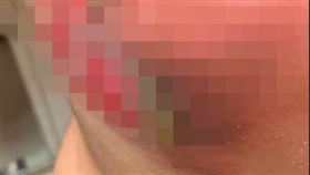 基隆,熱水,胡鬧,積極,燙傷,