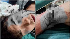 獎學金喬不攏！男大生遭2女報復…慘被水果刀「割斷腳筋」（圖／翻攝自微博）