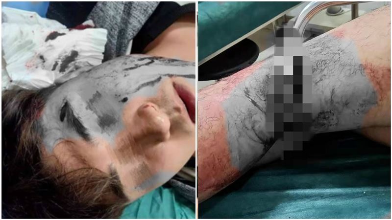 獎學金喬不攏！男大生慘遭2女斷腳筋