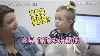 唐氏寶寶終於笑了！　世界不再寂靜