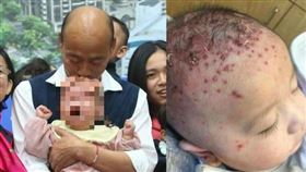 醫師姜冠宇貼出國民黨總統候選人韓國瑜親吻嬰兒頭部照片，並給與 批評，引發網友熱議。（圖／翻攝自醫師姜冠宇臉書粉絲團）