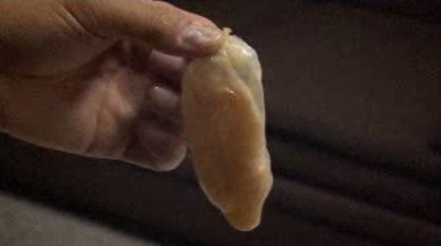 吞毒保險套球闖國門！男下機暴斃