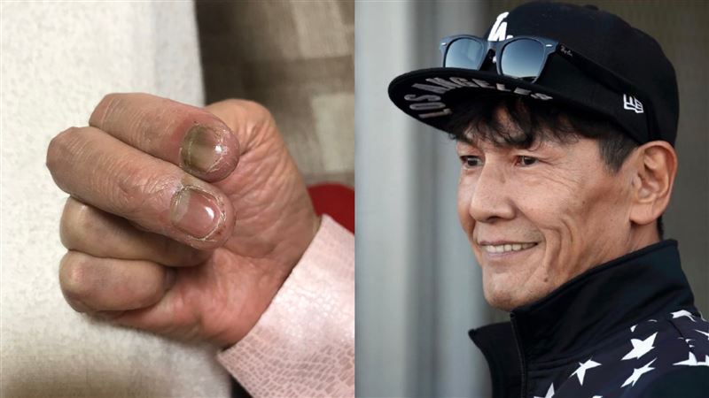 整隻黑掉 加藤鷹60歲現況曝名器 金手指 已破爛不堪 娛樂星聞 三立新聞網setn Com 整隻黑掉 加藤鷹60歲現況曝名器 金手指 已破爛不堪 娛樂星聞 三立新聞網setn Com