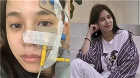 陳筱蕾，女星得腦瘤，面癱