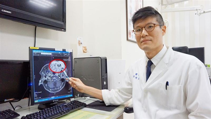 嘴傷逾兩週沒好　就醫檢查出口腔癌！