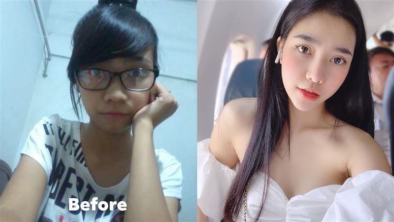 女偷整容成女神級正妹！母認不出氣炸