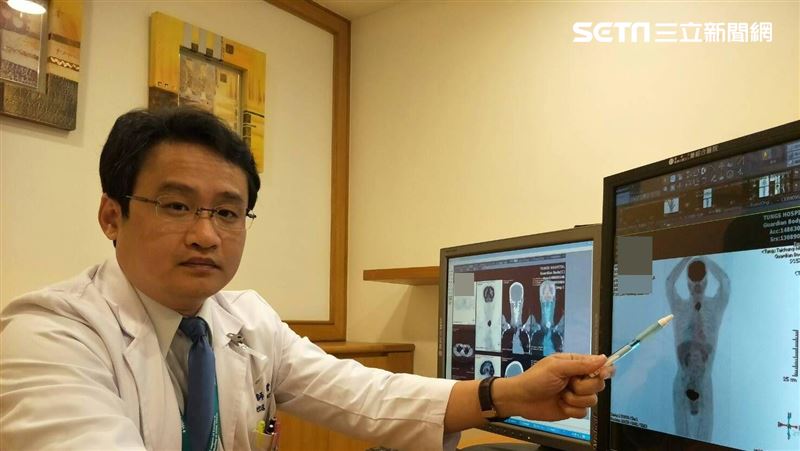 應酬常碰菸酒　男業務做這事揪食道癌