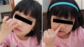 鼻孔會愈挖愈大？醫曝亂摳「3下場」