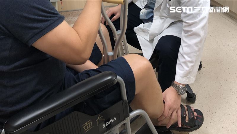 打球摔傷敷草藥　男小腿腫成煙燻火腿