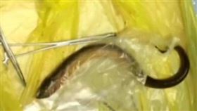 江西南昌男子體內有鱔魚／看看新聞