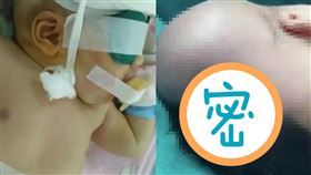 孕婦散步…胎兒突滑出　頭部墜地命危（翻攝自梨視頻）