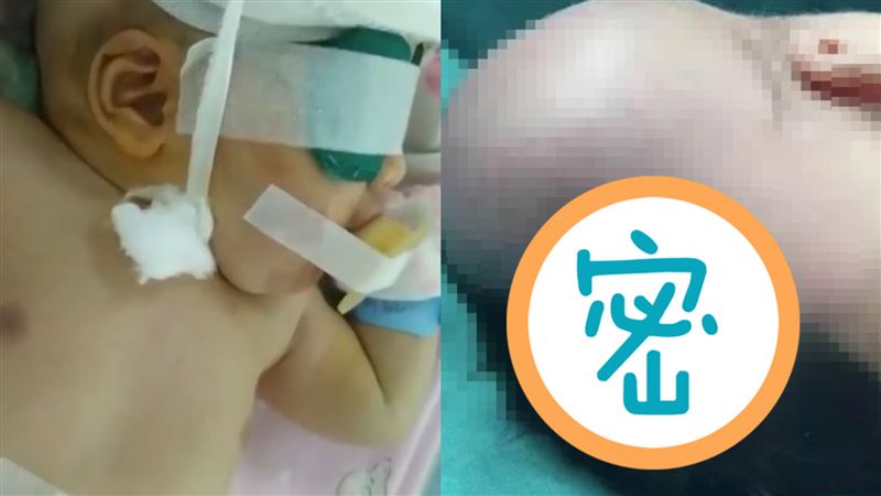 孕婦散步…胎兒突滑出　頭部墜地命危