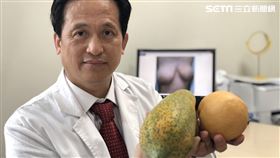 餵母乳,光田綜合醫院,整形外科,吳文宏,乳房,罩杯