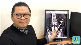 名家專用／NOW健康／高偉棠醫師指出，結石如果在腎臟越長越大，有時會沿著腎盂長得像鹿角一樣，此時體外震波若無法震碎結石，則可考慮採用高能摩西（Moses）鈥雷射手術粉碎較大結石。(勿用)