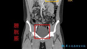 高中生,吃辣比賽,胃穿孔　圖／翻攝自《Dr. E 小兒急診室日誌》