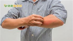 異位性皮膚炎是一種慢性且反覆發作的皮膚過敏發炎疾病，中重度患者一年四季都可能發病，且病情不僅會因季節性變化加劇，患者壓力變大也有可能導致病情惡化。