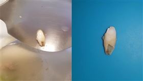 她喝骨肉湯！竟從口中吐出「怪異牙齒」　網一看安慰：正常（圖／翻攝自臉書）