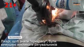 一名年約40歲的烏克蘭男子被妻子懷疑在外偷吃，妻子於是趁男子熟睡時報復；隔日男子被劇痛驚醒，才發現自己的「老二」被套上一個螺絲帽，怎麼拔都拔不下來，只好到醫院求援，最後院方搬出電鋸割開「貞操圈」，男子的命根子才終於獲救。（圖／翻攝自YouTube）