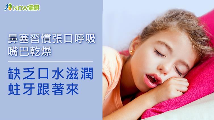 習慣張口呼吸　缺乏口水滋潤蛀牙來