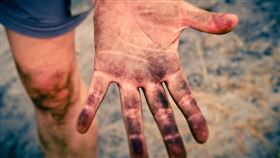 手指（示意圖／翻攝自pixabay）