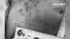 L小爸爸虐童2400