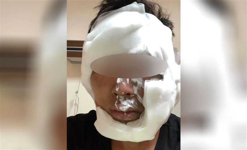 瓦斯罐滾入火堆　男肉身護童網讚爆