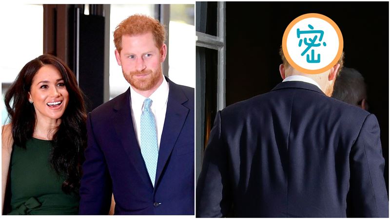 壓力太大？哈利也禿頭了…恐比威廉慘