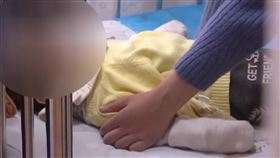 灰指甲,維生素,大陸,湖南,粗心,餵食,口腔,灼傷,潰爛,感染　圖／翻攝自微博