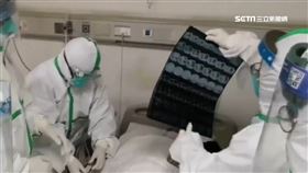 武漢肺炎再擴散 德國.斯里蘭卡病例確診