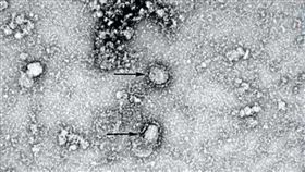 武漢肺炎病毒(中國疾病預防控制中心)