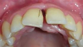 義大利,毛髮,牙齦,手術,避孕藥
https://twitter.com/ATInteresting/status/1225154657678479363/photo/1