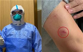 勇進確診重症病房！隔兩層防護衣…醫師遭患者「咬傷出血」（圖／翻攝自微博）