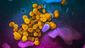 美國專家近日公布在掃描式電子顯微鏡上觀察到的新型冠狀病毒影像，病毒上黃色，細胞表面上藍色和粉紅色。（圖／翻攝自NIAID flickr網頁；作者：NIAID-RML，CC BY 2.0）
