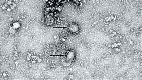 武漢肺炎病毒（中國疾病預防控制中心）