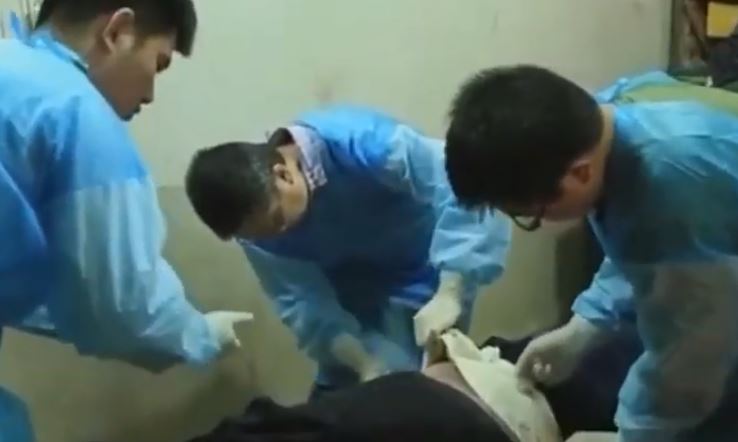 武肺死者解剖　專家曝：肺部沾滿黏液