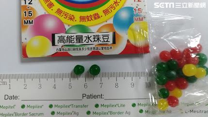 幼童誤吞水晶寶寶　體內脹大5倍卡腸