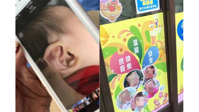 不只4童受害？托嬰中心再爆捏傷幼童