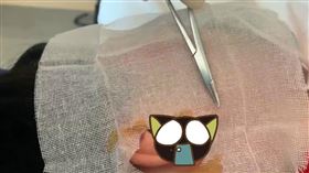 同事耳朵受傷　援鄂醫生用頭髮縫合（圖／翻攝自梨視頻）