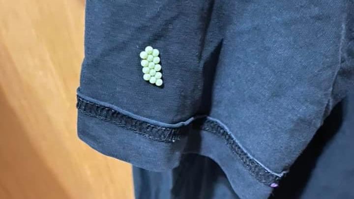 衣上「整排綠蛋」　網一看嚇壞：有毒