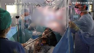 英女右腦長腦瘤 邊開刀邊拉琴