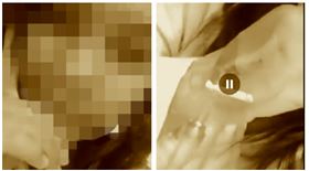 女看護,印尼,武漢肺炎,染病,