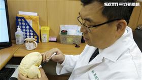 舌頭痛,台中慈濟醫院,神經外科,林英超,手術,腦內皮上瘤,瘤脂肪,三叉神經
圖／台中慈院提供