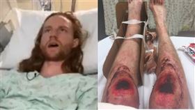 活動,美國,登山,跑步,遇難,爬行,骨折,膝蓋,重傷,家人,滑倒,積雪,零下, 圖／翻攝自推特