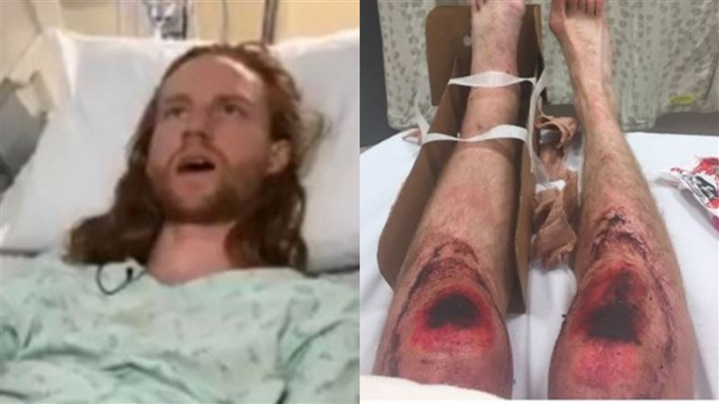 跑男冰地滑倒斷腿　爬地10小時求救