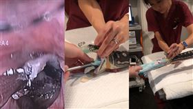 蟒蛇,寵物,毛巾,獸醫,拯救,內視鏡,吞食,鉗子, 圖／翻攝自YouTube