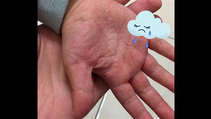 師天天噴消毒　女兒洗澡痛到哭她心碎