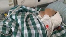 天降紅磚！14月大男嬰「頭部凹陷」慘爆血…送醫後腦死（圖／翻攝自廣州日報微博）