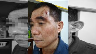 三峽宮廟遶境爆衝突　員警遭劃傷額頭